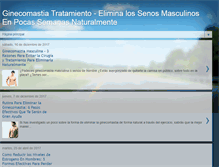 Tablet Screenshot of ginecomastiatratamiento.blogspot.com