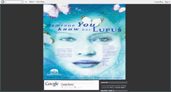 Desktop Screenshot of care4lupus.blogspot.com