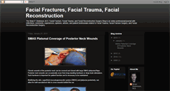 Desktop Screenshot of facialfractures.blogspot.com