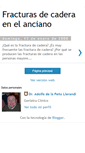 Mobile Screenshot of fracturascaderaanciano.blogspot.com