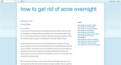 Desktop Screenshot of howtogetridofacneovernight.blogspot.com