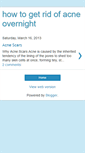 Mobile Screenshot of howtogetridofacneovernight.blogspot.com