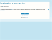 Tablet Screenshot of howtogetridofacneovernight.blogspot.com