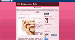 Desktop Screenshot of blanqueamientodentaludc.blogspot.com