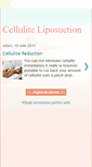 Mobile Screenshot of celluliteandliposuction.blogspot.com