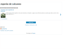 Tablet Screenshot of esporaodecalcaneo-simpatia.blogspot.com