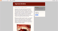 Desktop Screenshot of agenesiadentaria.blogspot.com