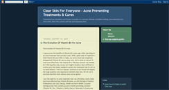 Desktop Screenshot of cureyouracne.blogspot.com