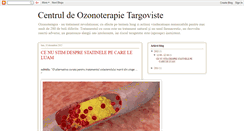 Desktop Screenshot of centruldeozonoterapietargoviste.blogspot.com