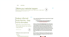 Desktop Screenshot of howtogetridofaboilfast.blogspot.com