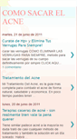 Mobile Screenshot of comosacarelacne.blogspot.com