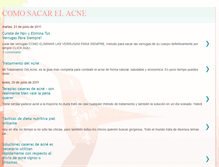 Tablet Screenshot of comosacarelacne.blogspot.com