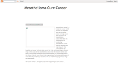 Desktop Screenshot of mesotheliomacancercureasbestos.blogspot.com