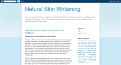 Desktop Screenshot of natural-skin-whitening.blogspot.com