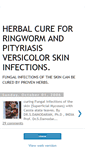 Mobile Screenshot of curing-fungal.blogspot.com