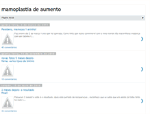 Tablet Screenshot of aminhamamoplastiadeaumento.blogspot.com