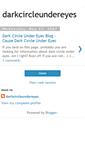 Mobile Screenshot of darkcircleundereyes.blogspot.com