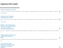 Tablet Screenshot of liposuccion-laser.blogspot.com