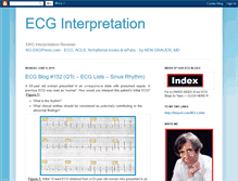 Tablet Screenshot of ecg-interpretation.blogspot.com