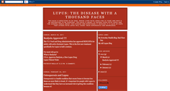 Desktop Screenshot of lupusathousandfaces.blogspot.com