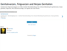 Tablet Screenshot of genitalwarzen-feigwarzen.blogspot.com