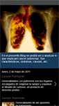 Mobile Screenshot of parcancerpulmonar.blogspot.com