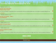 Tablet Screenshot of eczemanaturalremediesforyou.blogspot.com