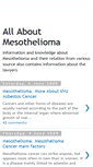 Mobile Screenshot of guideofmesothelioma.blogspot.com