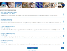 Tablet Screenshot of lasiksurgery-services.blogspot.com