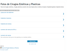 Tablet Screenshot of fotosdecirugiasesteticas.blogspot.com