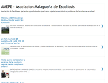Tablet Screenshot of escoliosismalaga.blogspot.com