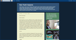 Desktop Screenshot of best-teeth-implants.blogspot.com