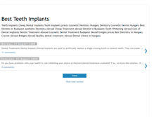 Tablet Screenshot of best-teeth-implants.blogspot.com