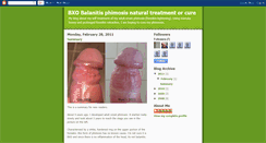 Desktop Screenshot of bxo-phimosis.blogspot.com