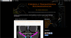 Desktop Screenshot of cirurgiaetraumabucomaxilofacial.blogspot.com
