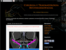 Tablet Screenshot of cirurgiaetraumabucomaxilofacial.blogspot.com