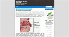 Desktop Screenshot of caramengobatipoliphidungtanpaoperasi.blogspot.com