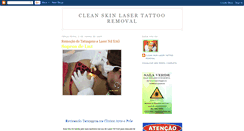 Desktop Screenshot of cleanskinlaser.blogspot.com