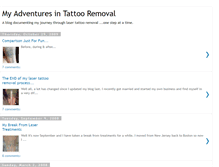 Tablet Screenshot of mytattooremoval.blogspot.com