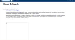 Desktop Screenshot of cancerdehigado.blogspot.com