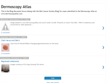 Tablet Screenshot of dermoscopyatlas.blogspot.com