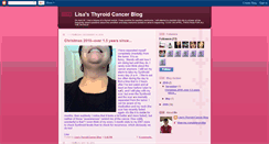 Desktop Screenshot of lisasthyroid.blogspot.com