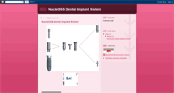 Desktop Screenshot of nucleoss-implant.blogspot.com