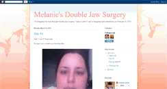 Desktop Screenshot of melaniesjawsurgery.blogspot.com