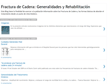 Tablet Screenshot of fracturadecadera.blogspot.com