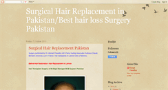 Desktop Screenshot of hair-replacemement-pakistan.blogspot.com