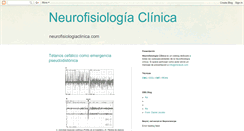 Desktop Screenshot of neurofisiologiaclinica.blogspot.com