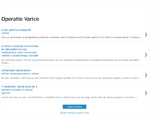 Tablet Screenshot of operatie-varice.blogspot.com