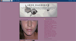 Desktop Screenshot of aknedagboken.blogspot.com