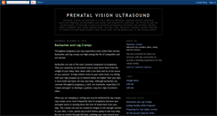 Desktop Screenshot of prenatalvision.blogspot.com